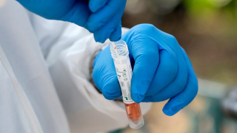 Η Βρετανία θα εξετάσει αν η μετάγγιση με πλάσμα από επιζώντες του ιού βοηθά τους ασθενείς με κορωνοϊό