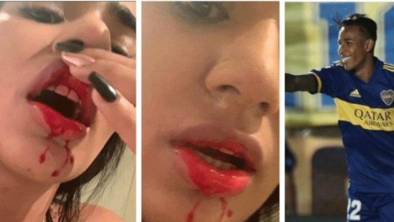 Παίκτης της Μπόκα Τζούνιορς έδειρε και άφησε αιμόφυρτη τη σύντροφό του!