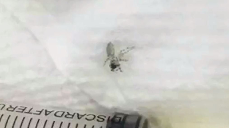 Κίνα: Γιατρός αφαίρεσε ζωντανή αράχνη από το αφτί γυναίκας