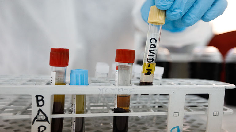 Αναστολή λειτουργίας μόνο σε τμήματα εγκαταστάσεων επιχείρησης όπου εντοπίζεται κρούσμα