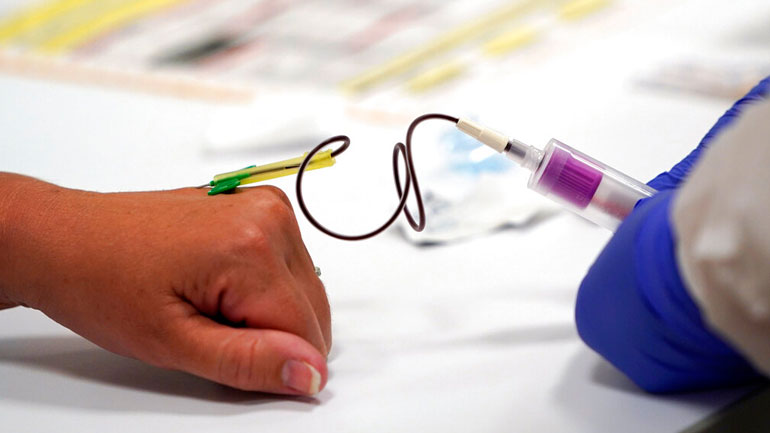 Ελβετική φαρμακοβιομηχανία έλαβε έγκριση για να χρησιμοποιήσει τεστ αντισωμάτων