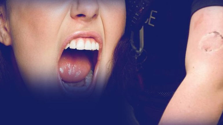 Απίστευτο: Γυναίκα δάγκωσε αστυνομικό που κλήθηκε να τη βοηθήσει