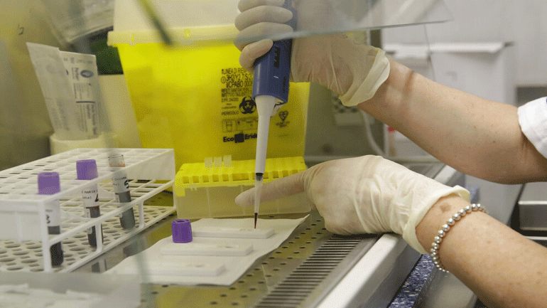 Αμερικανική έρευνα: Η χορήγηση υδροχλωρικίνης δεν έχει αποτέλεσμα σε ασθενείς με Covid-19