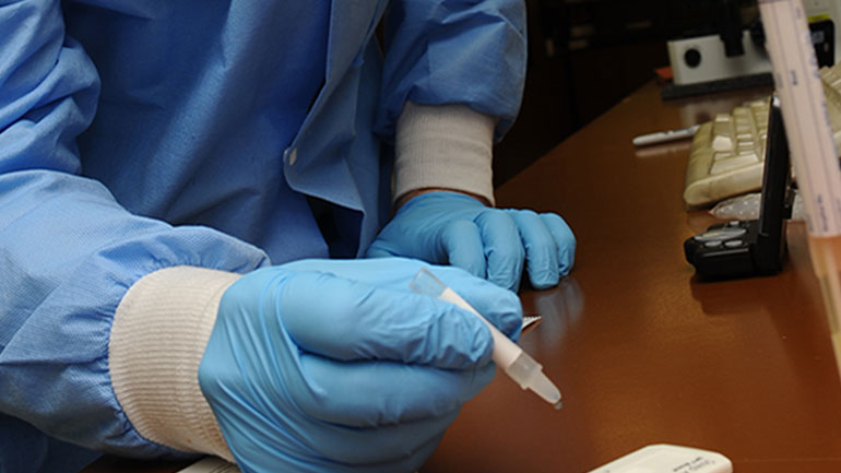 Πώς αντιμετωπίζονται τα υψηλά επίπεδα τεστοστερόνης στις γυναίκες;