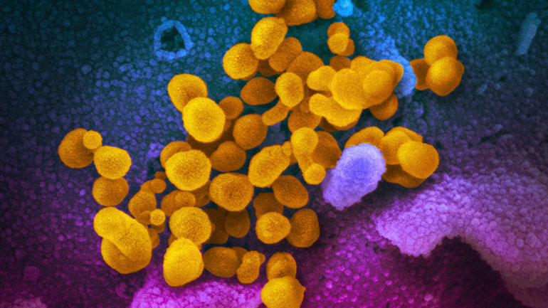 Τσιόδρας: Λάθος να πιστεύουμε ότι οι υψηλές θερμοκρασίες μάς προστατεύουν από τον ιό