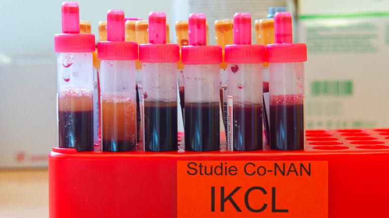 Περισσότερα από 4,64 εκατομμύρια κρούσματα παγκοσμίως με 310.236 θανάτους