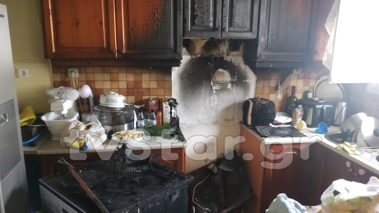Εύβοια: Με σοβαρά εγκαύματα 47χρονη από φωτιά στο σπίτι της
