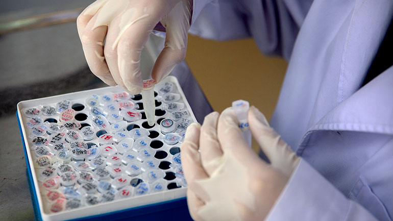 ΠΟΥ: Η επανεξέταση για την ασφάλεια της υδροξυχλωροκίνης θα ολοκληρωθεί μέχρι τα μέσα Ιουνίου