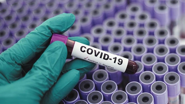 Η MSD στη μάχη κατά του Covid-19 με τρεις νέες σημαντικές ερευνητικές πρωτοβουλίες