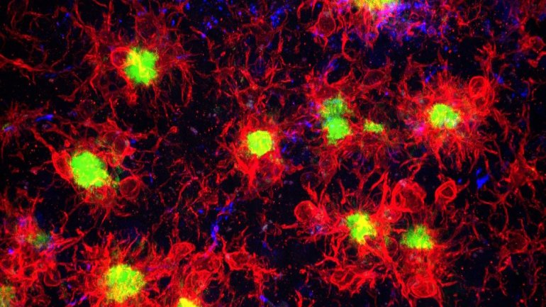 To ανοσοποιητικό του εγκεφάλου προστατεύει από ασθένειες, αλλά μπορεί και να τις προκαλέσει To ανοσοποιητικό του εγκεφάλου προστατεύει από ασθένειες, αλλά μπορεί και να τις προκαλέσει