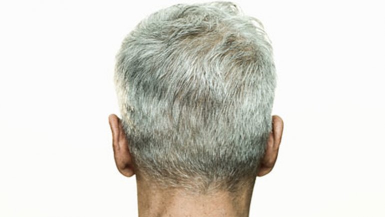 Το γκριζάρισμα των μαλλιών που οφείλεται στο άγχος μπορεί να αντιστραφεί