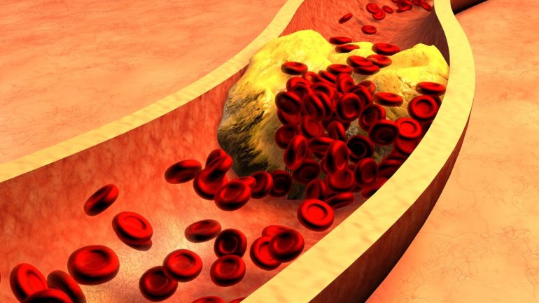 Τα επίπεδα χοληστερόλης μειώνονται στο δυτικό κόσμο