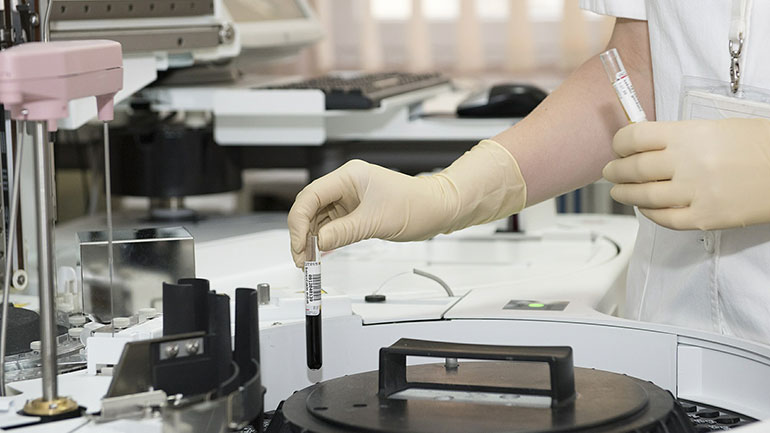 Καρκίνος του κόλπου: παράγοντες κινδύνου και πρόληψη