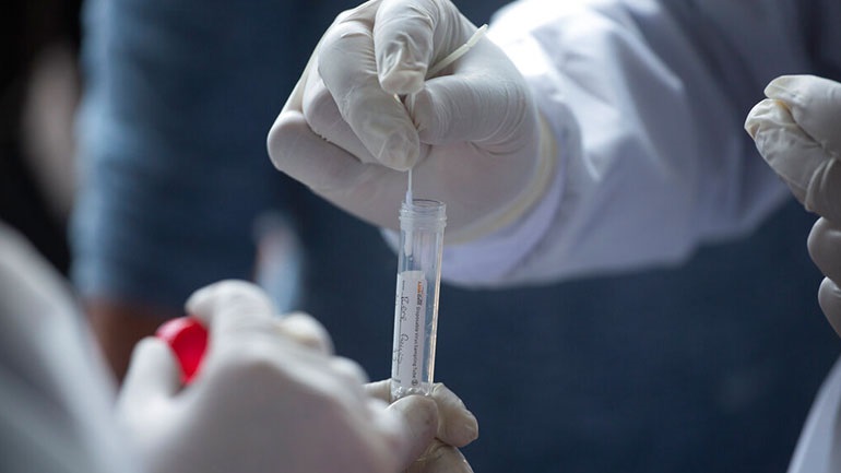 Διάγνωση της νόσου Covid-19 με λήψη δείγματος από τον ίδιο τον ασθενή