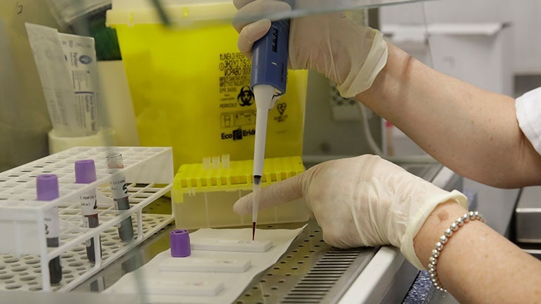 Είναι αξιόπιστα τα τεστ αντισωμάτων για τον SARS-CoV-2 και σε ποιον βαθμό;  