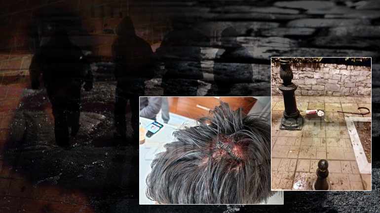 “Είμαι τυχερός που είμαι ζωντανός”