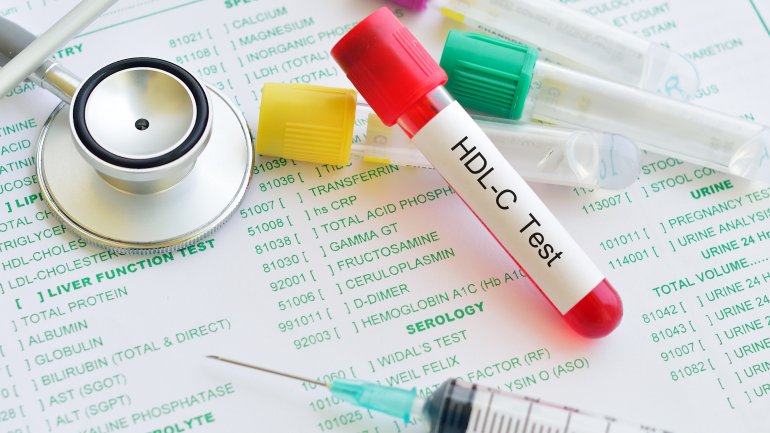 HDL χοληστερόλη: Πώς μπορεί να βοηθήσει στην πρόβλεψη καρδιαγγειακών παθήσεων