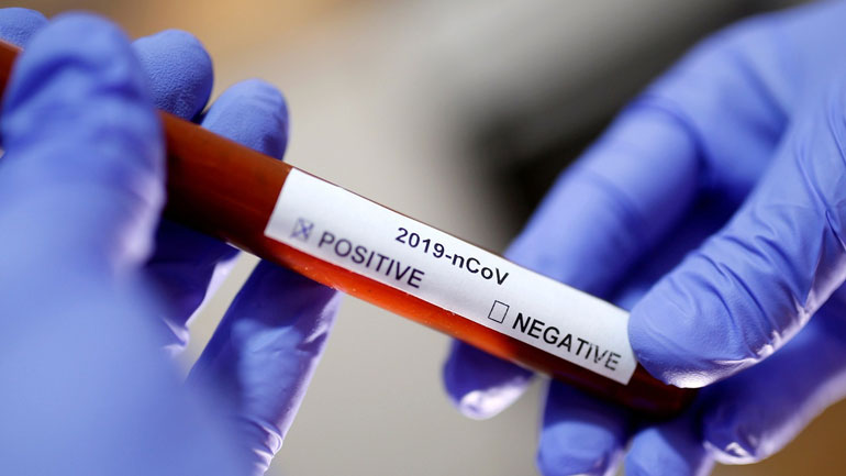 Παραμένουν τα μέτρα στο Τέξας για τον κορωνοϊό λόγω αύξησης των κρουσμάτων