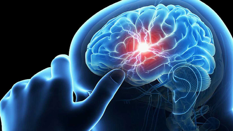 Ο Covid-19 μπορεί να προκαλέσει βλάβες στον εγκέφαλο