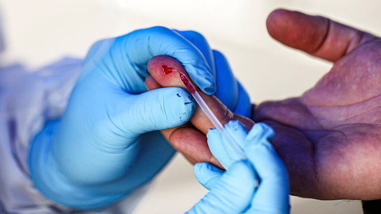 Covid-19: Πάνω από 495.000 νεκροί παγκοσμίως – 9.875.000 τα κρούσματα