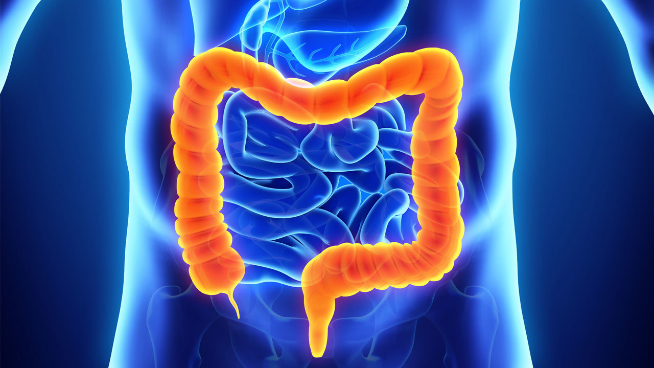 Καρκίνος του παχέος εντέρου: Πώς μπορεί να προληφθεί ένας από τους συχνότερους καρκίνους;