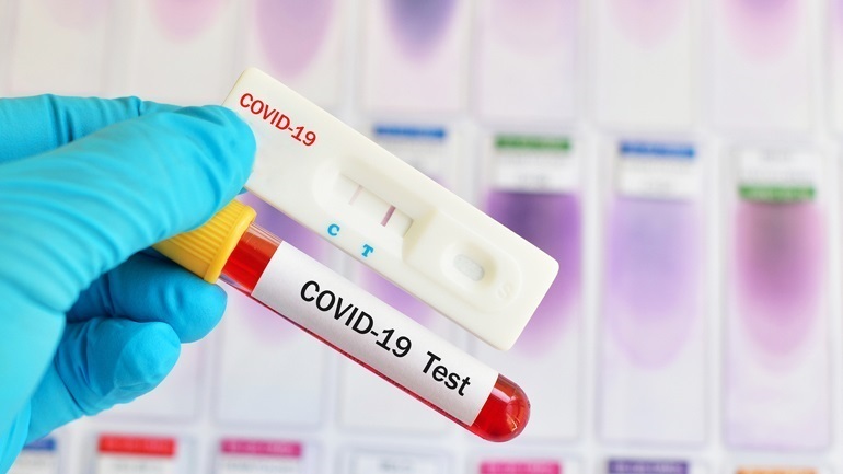 Χαρακτηριστικά και έκβαση ασθενών με COVID-19 και οξύ ισχαιμικό εγκεφαλικό επεισόδιο