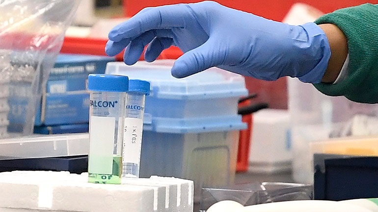 Κορωνοϊός: Το εμβόλιο από το Πανεπιστήμιο της Οξφόρδης και την AstraZeneca θα προσφέρει διπλή προστασία