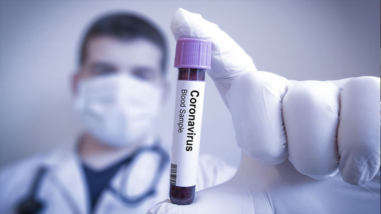 Έρχονται ανακοινώσεις για το υποψήφιο εμβόλιο της Οξφόρδης κατά του κορωνοϊού