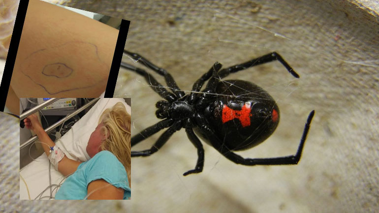 Συναγερμός από τσιμπήματα «μαύρης χήρας» στη Δυτική Ελλάδα