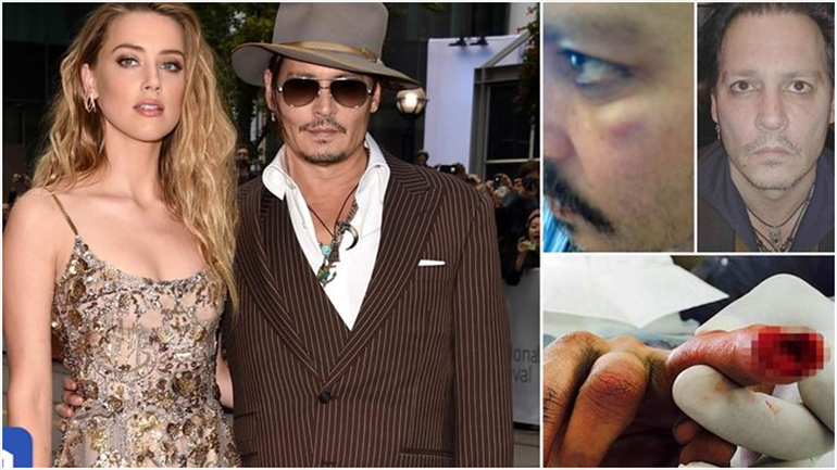 Amber Heard στη δίκη κατά του Johnny Depp: «Μου έριχνε μπουκάλια σαν χειροβομβίδες»