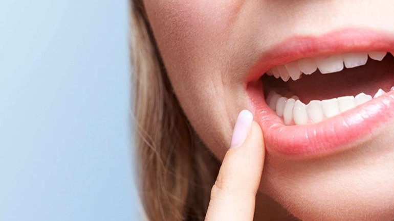 Η περιοδοντίτιδα μπορεί να αυξήσει τον κίνδυνο ορισμένων καρκίνων