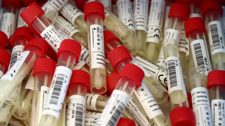 Τσεχία: Συνεχίζεται η αύξηση των νέων κρουσμάτων κορωνοϊού