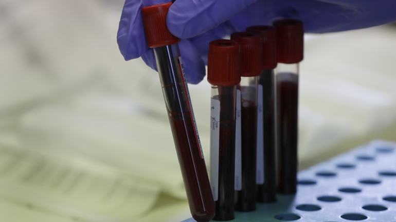 Συμφωνία Κομισιόν – Sanofi για το εμβόλιο κατά του κορωνοϊού