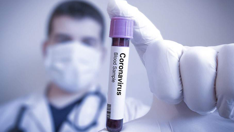 Η Ρωσία υπόσχεται εκατοντάδες χιλιάδες δόσεις ενός εμβολίου για τον κορωνοϊό από το 2020