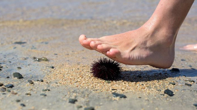 Τι πρέπει να κάνετε εάν πατήσετε δράκαινα ή αχινό στη θάλασσα;