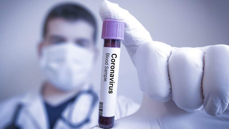 Παρέμβαση στο zougla.gr από τον καθηγητή Φαρμακολογίας του ΑΠΘ, Δημήτρη Κούβελα, για το νέο εμβόλιο