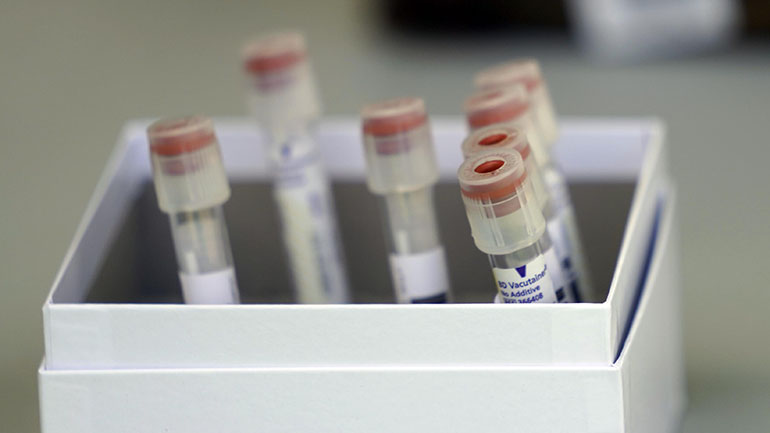 Η Γερμανία εξετάζει την κατάργηση των υποχρεωτικών τεστ κορωνοϊού για όσους επιστρέφουν από το εξωτερικό