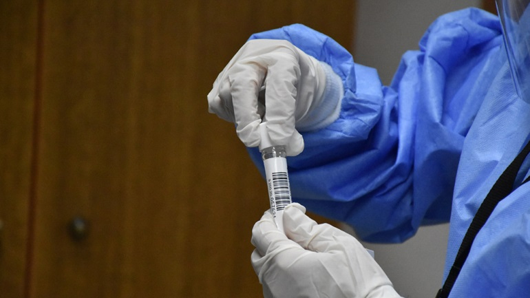 ΕΚΘ: Το τεστ για τον κορωνοϊό να καλύπτεται από τους εργοδότες