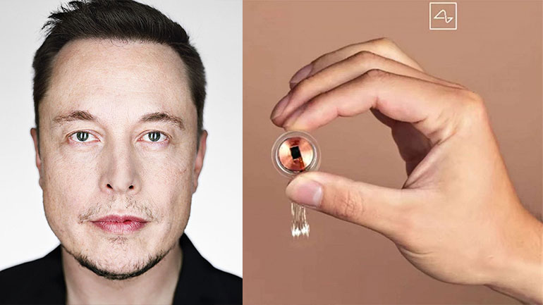Τσιπ για τον εγκέφαλο από τον Έλον Μασκ