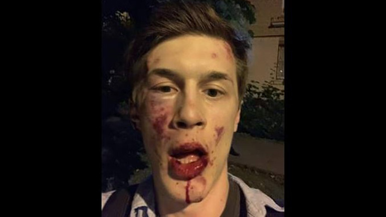 Ρωσία: Γνωστός μπλόγκερ και ακτιβιστής της αντιπολίτευσης υπέστη ξυλοδαρμό