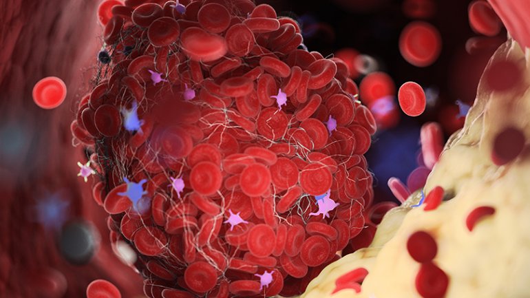 Ιατρείο Λιπιδίων Metropolitan Hospital: Το πρώτο βήμα σε έναν δρόμο που σώζει ζωές