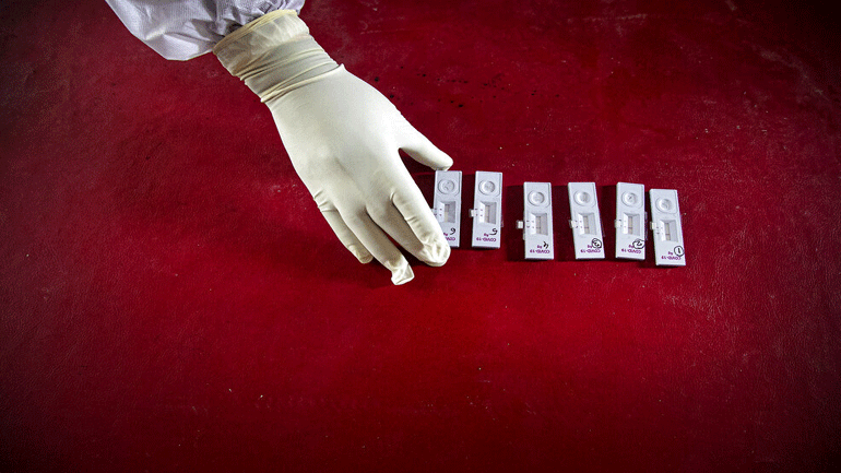 Ονδούρα: Θετικός στον COVID-19 ο υπουργός Οικονομικών