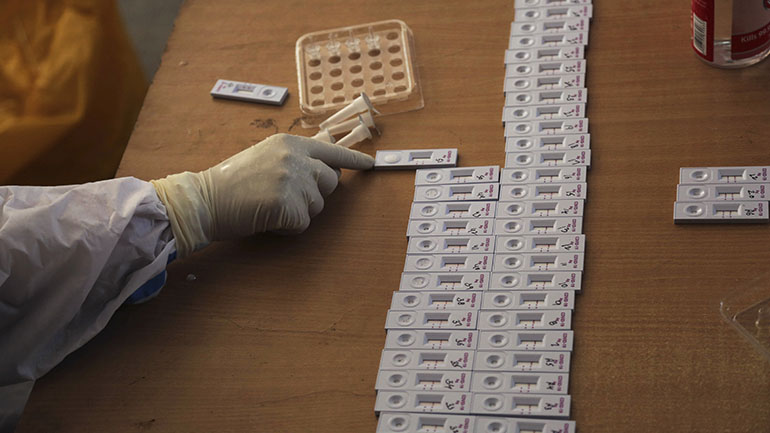 Ιταλία: Νέο γρήγορο τεστ σιέλου με διάγνωση κορωνοϊού σε τρία λεπτά Ιταλία: Νέο γρήγορο τεστ σιέλου με διάγνωση κορωνοϊού σε τρία λεπτά