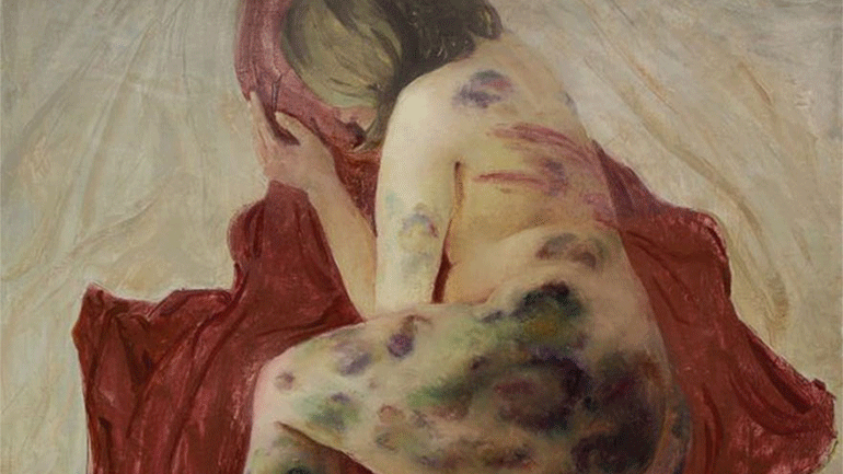 «Η Αφροδίτη της Λευκορωσίας» καταγγέλλει την αστυνομική βία