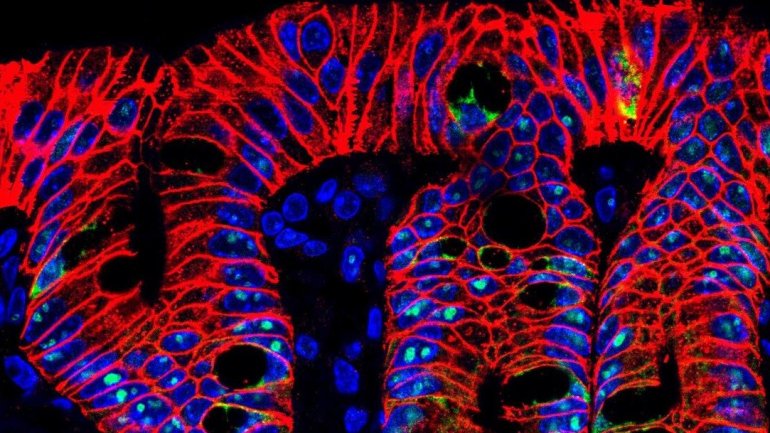 Γιατί τα χολικά οξέα είναι σημαντικά για το έντερο