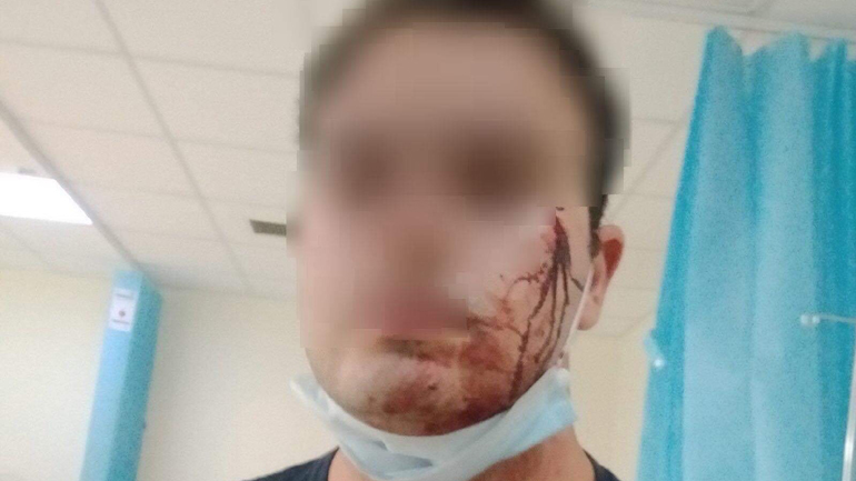 Καταυλισμός Αχαρνών: Επιτέθηκαν στους αστυνομικούς που πήγαν να “χαλάσουν” το γλέντι – Δύο τραυματίες