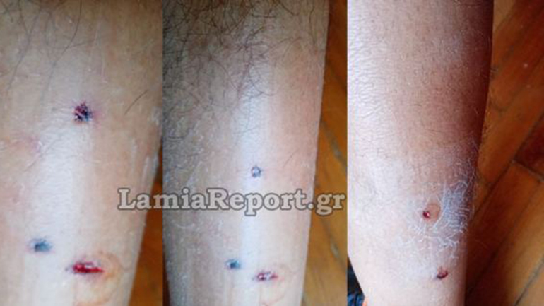 Λαμία: Επίθεση σκύλου σε δικυκλιστή