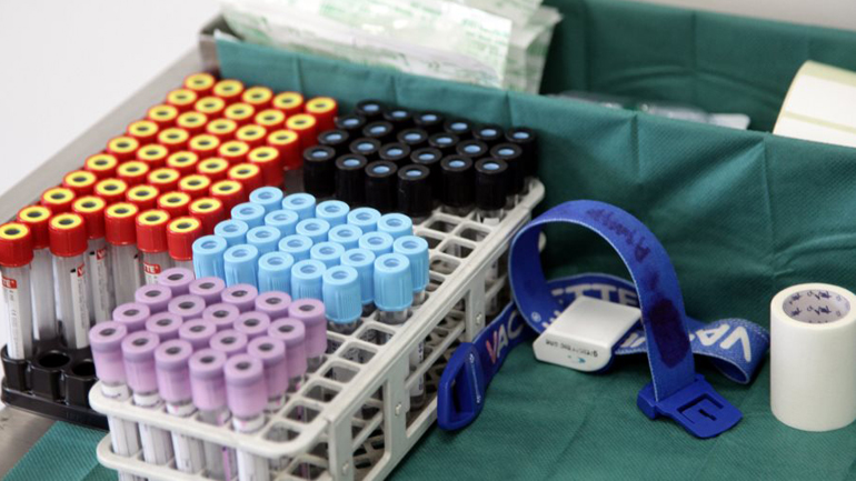 Οι ασθενείς με αιματολογικές κακοήθειες εμφανίζουν υψηλότερο ιικό φορτίο του κορωνοϊού και αυξημένο κίνδυνο θανάτου