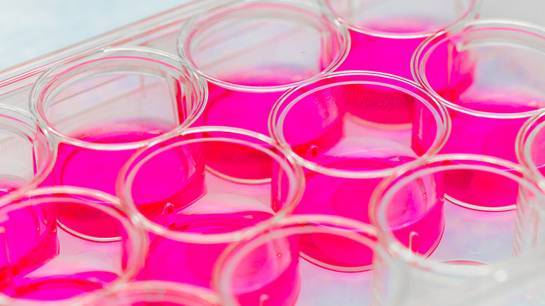 Η θεραπεία με βλαστοκύτταρα και η στυτική λειτουργία σε άνδρες με ισχαιμική καρδιομυοπάθεια