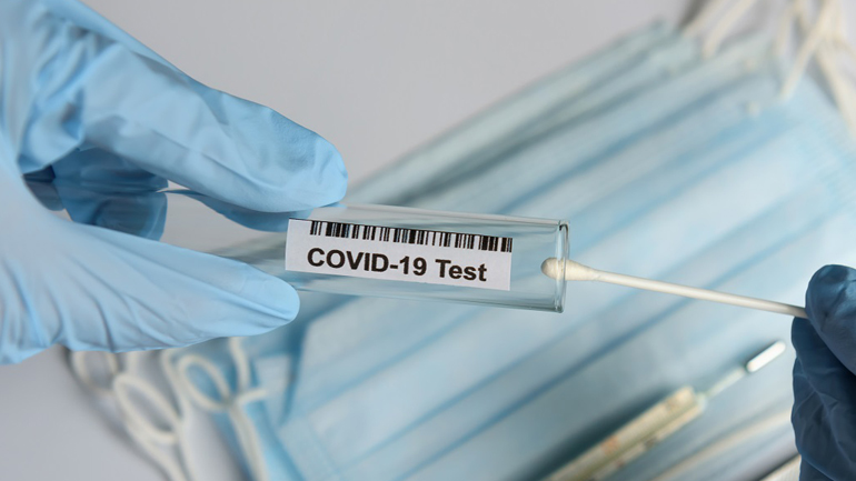“Επείγουσα έγκριση χρήσης” έλαβε από την FDA τεστ της εταιρείας Eurofins για τον κορωνοϊό
